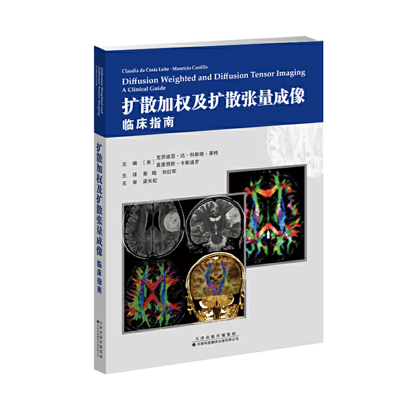 �U(ku��)ɢ�ә�(qu��n)���U(ku��)ɢ���������R��ָ��