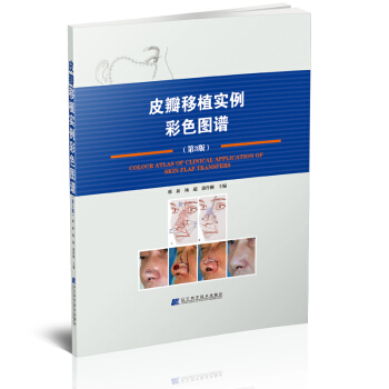 Ƥ����ֲ��(sh��)����ɫ�D�V����3�棩