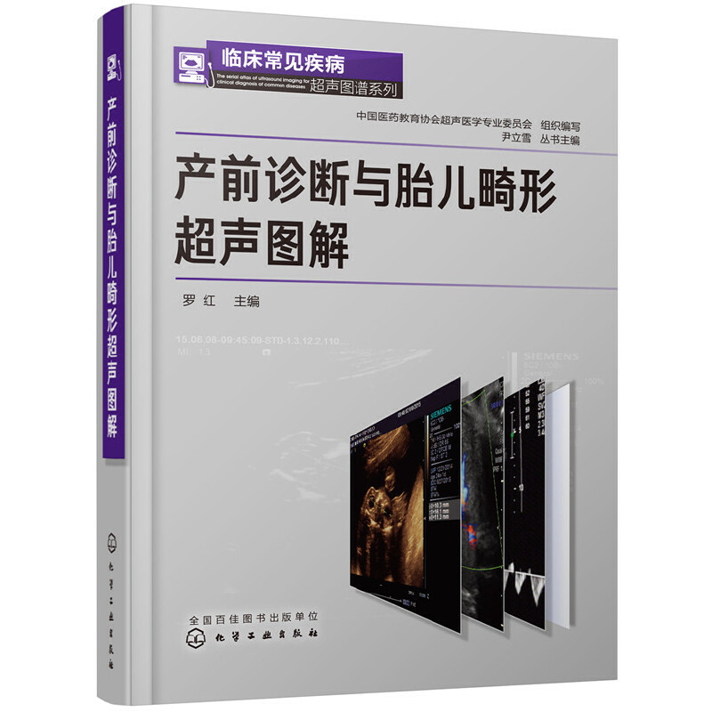 �R����Ҋ(ji��n)�������D�Vϵ��--�a(ch��n)ǰ�\���c̥�����γ��D��