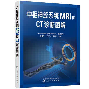 �И���(j��ng)ϵ�y(t��ng)MRI��CT�\���D��