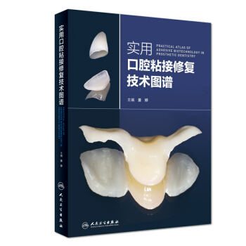 ���ÿ�ǻճ���ޏ�(f��)���g(sh��)�D�V