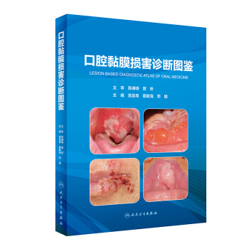 ��ǻ�Ĥ�p���\���D�b