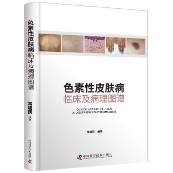 ɫ����Ƥ�w�����R��������D�V