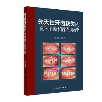 ���������Xȱʧ���R���\��������ί�