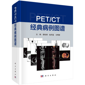 PET/CT ��(j��ng)�䲡���D�V