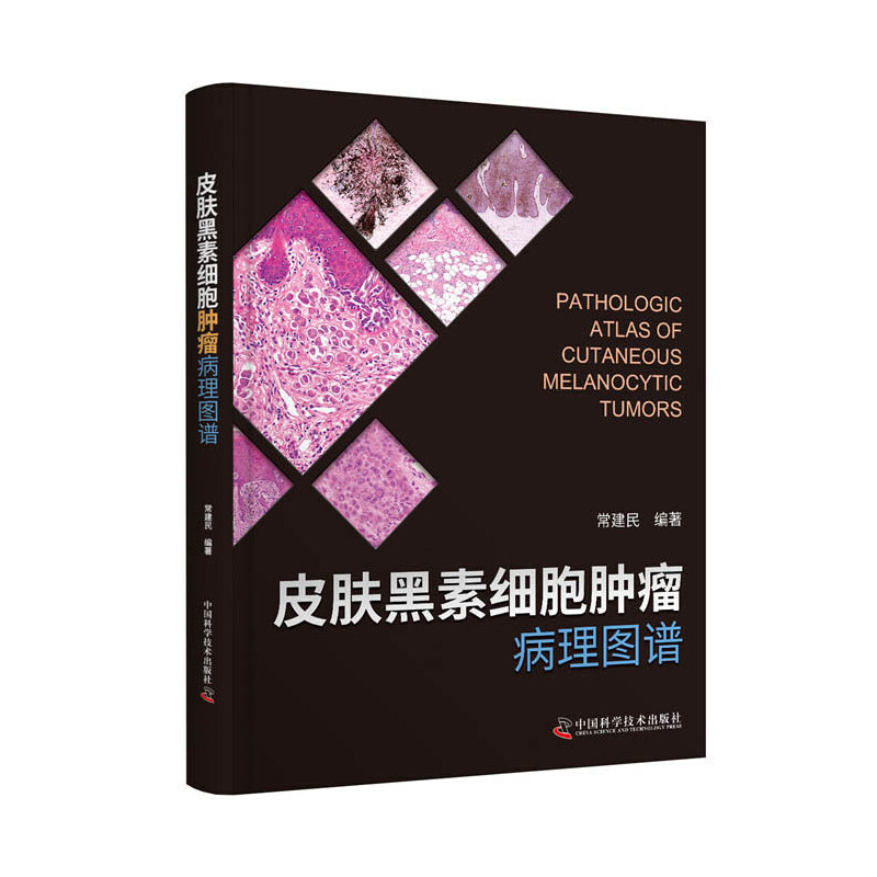 Ƥ�w���ؼ����[������D�V