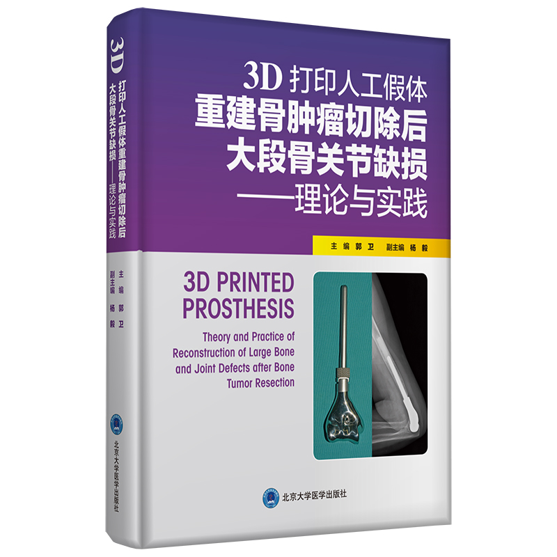 3D��ӡ�˹����w�ؽ����[���г����ι��P��(ji��)ȱ�p������Փ�c���`