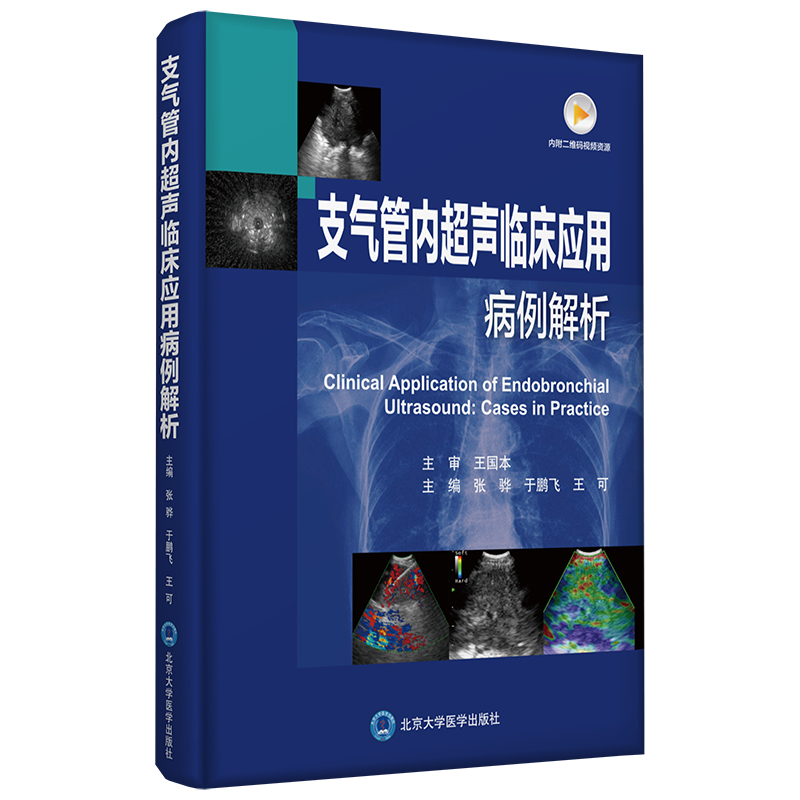 ֧��܃�(n��i)���R����(y��ng)�ò�������