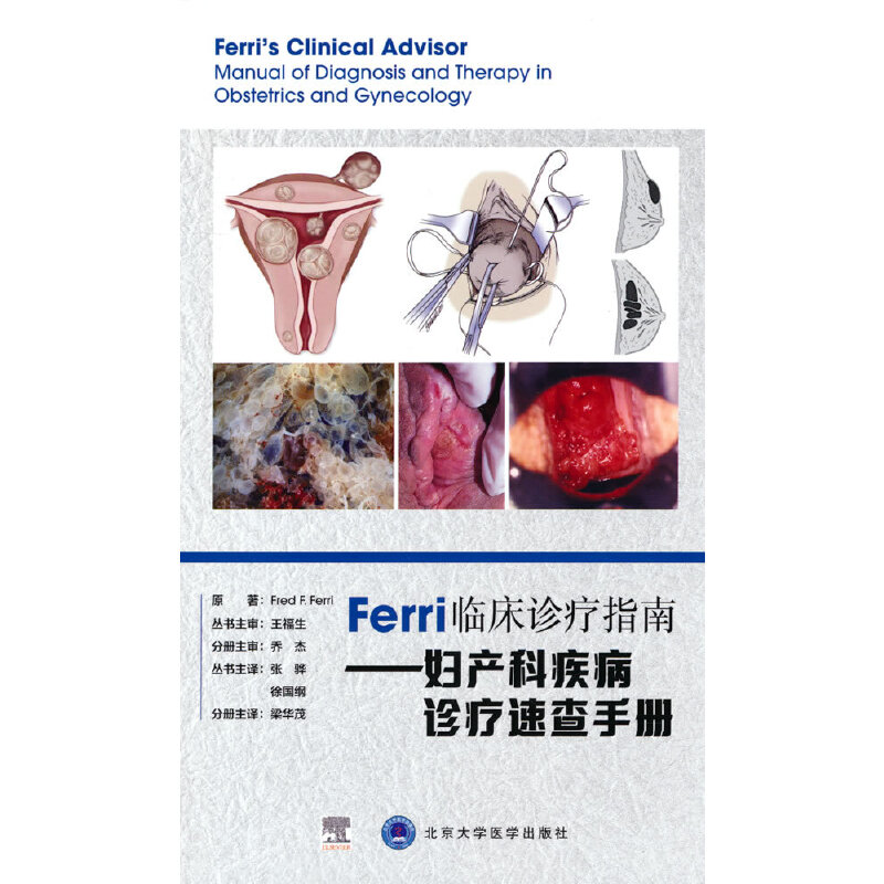 Ferri�R���\��ָ�ϡ����D�a(ch��n)�Ƽ����\���ٲ��փ�(c��)