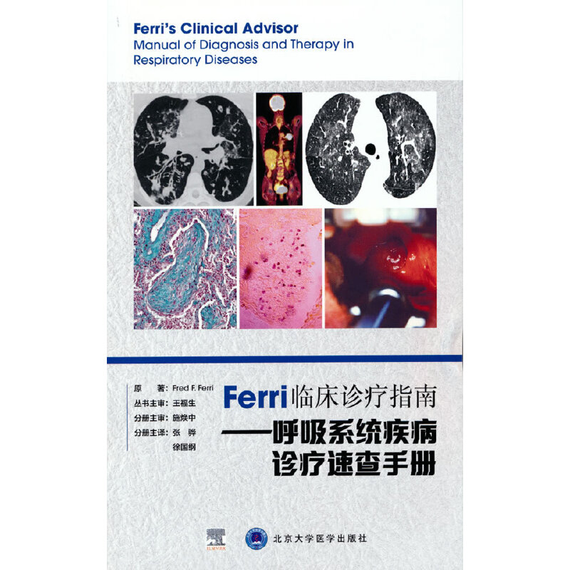 Ferri�R���\��ָ�ϡ�������ϵ�y(t��ng)�����\���ٲ��փ�