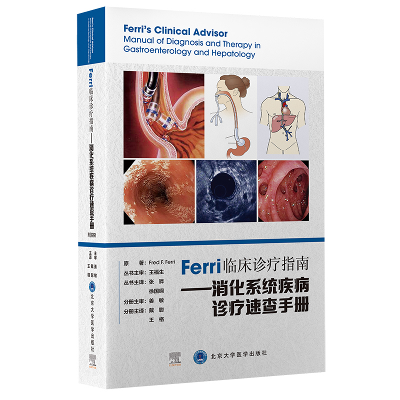 Ferri�R���\��ָ�ϡ�������ϵ�y(t��ng)�����\���ٲ��փ�(c��)