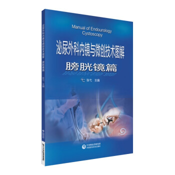 ������ƃ�(n��i)�R�c΢��(chu��ng)���g(sh��)�D��-�����Rƪ