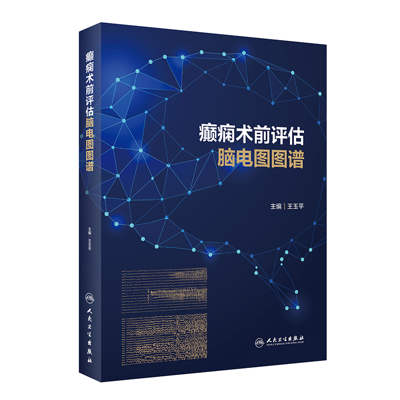 �d�B�g(sh��)ǰ�u(p��ng)���X늈D�D�V