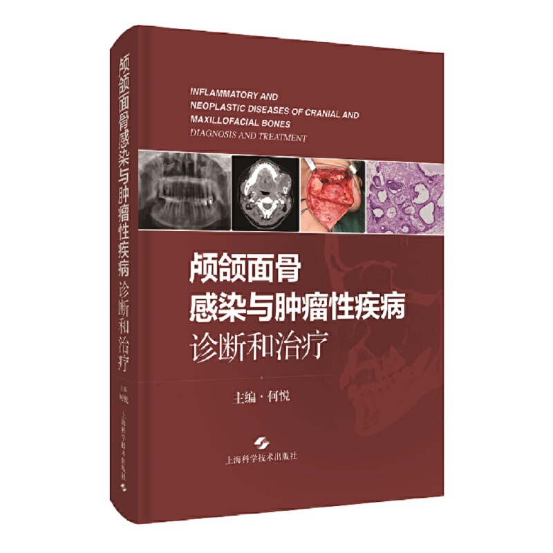 �B�M��Ǹ�Ⱦ�c�[���Լ���:�\����ί�