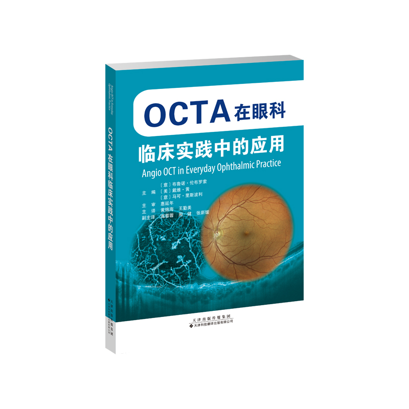 OCTA���ۿ��R�����`�еđ���