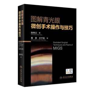 �D�������΢��(chu��ng)���g(sh��)�����c����