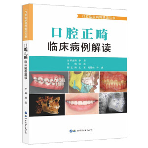 ��ǻ�����R���������x