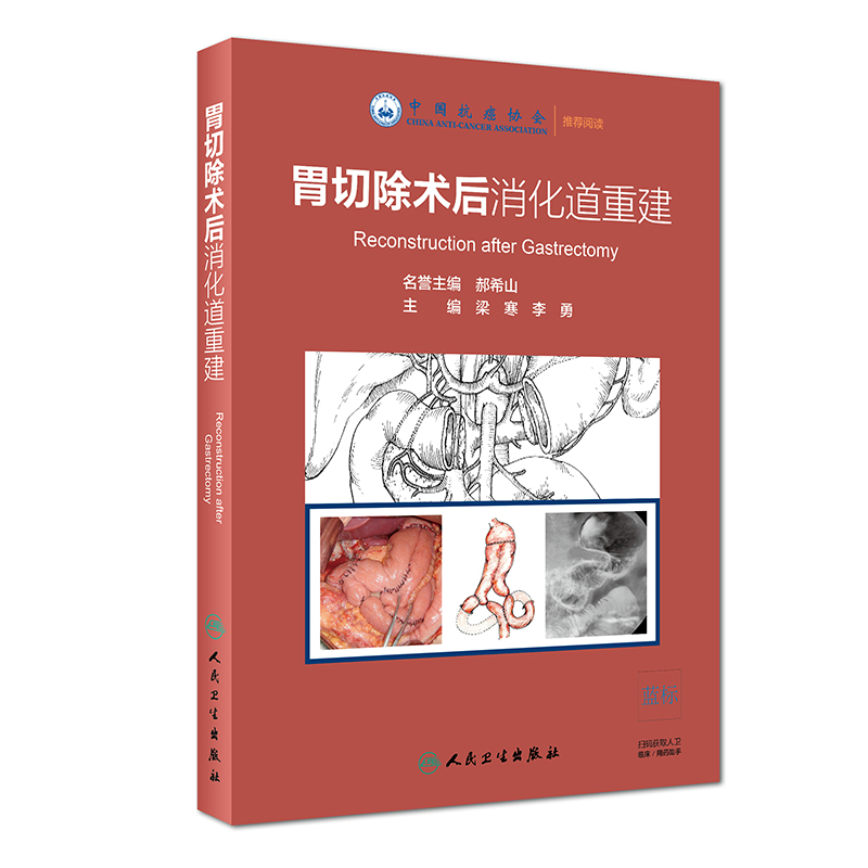 θ�г��g(sh��)���������ؽ�