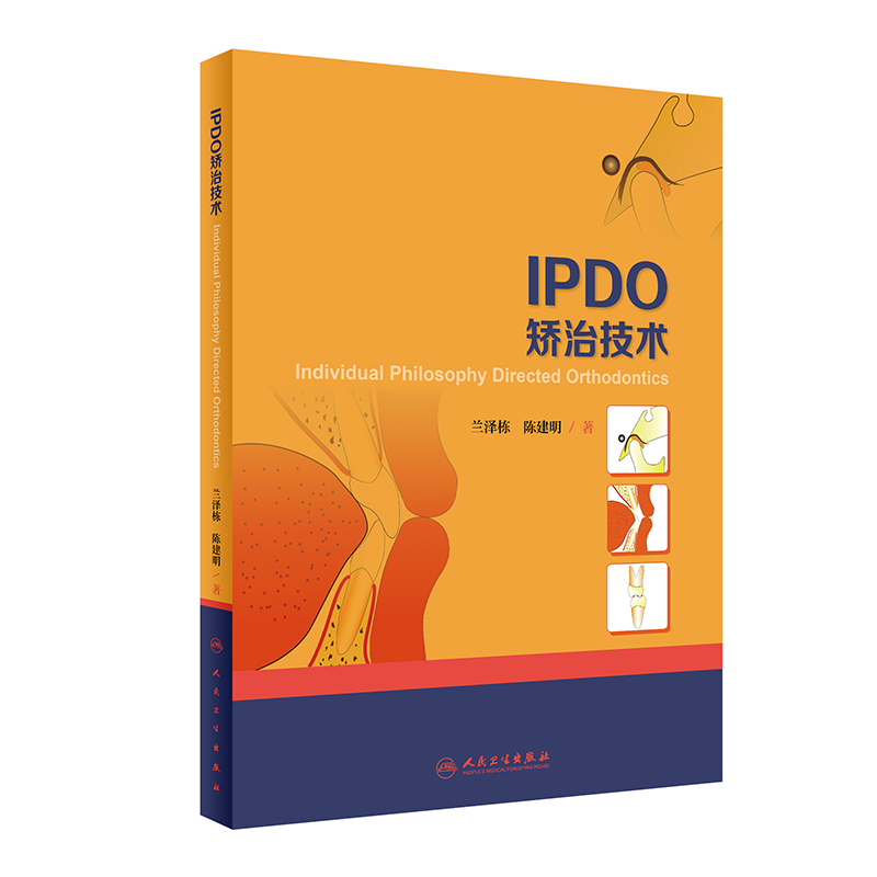 IPDO�C�μ��g(sh��)