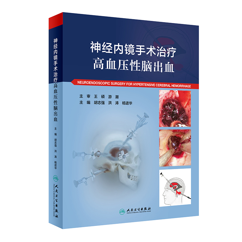 ��(j��ng)��(n��i)�R���g(sh��)�ί���Ѫ�����X��Ѫ