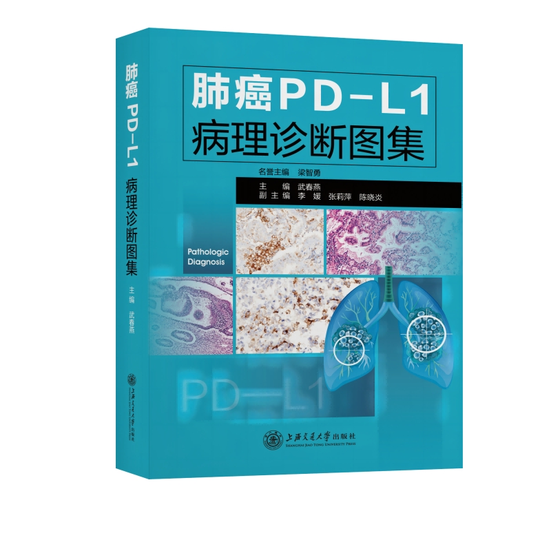 �ΰ�PD-L1�����\���D��