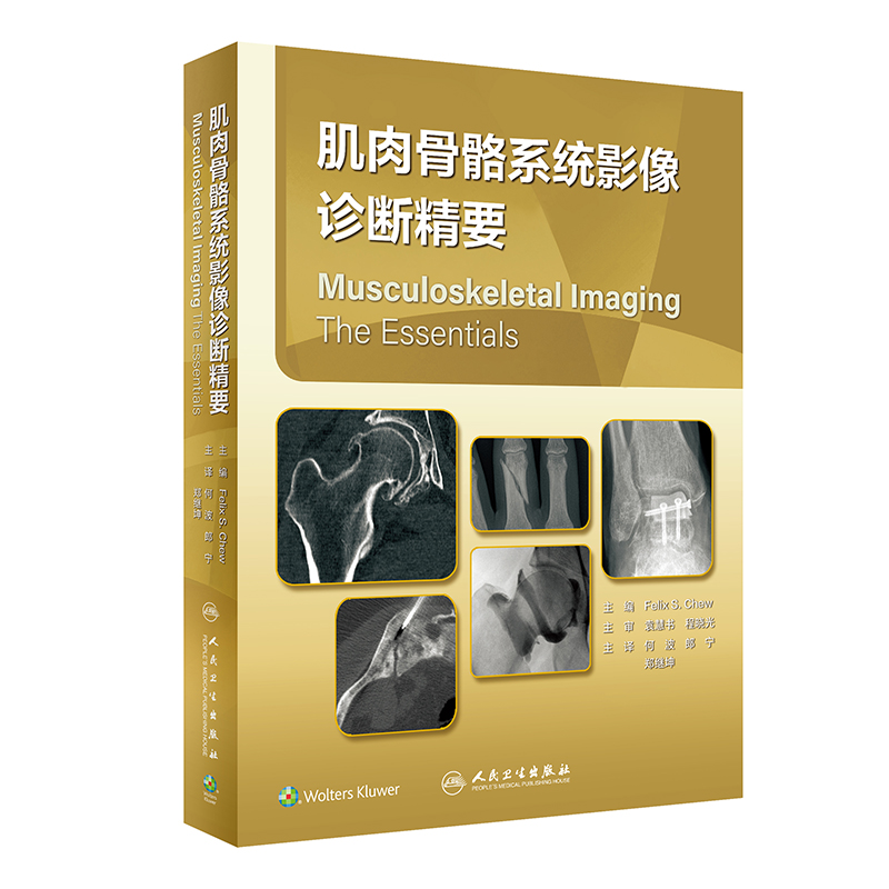 �������ϵ�y(t��ng)Ӱ���\�ྫҪ