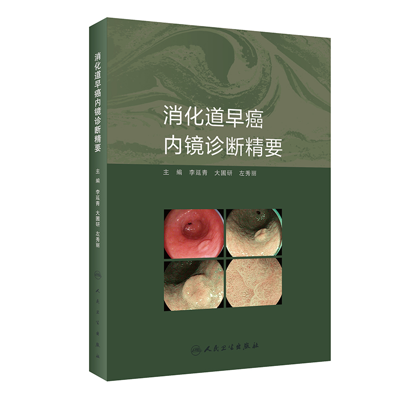 �������簩��(n��i)�R�\�ྫҪ