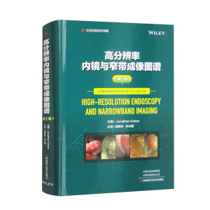 �߷ֱ��ʃ�(n��i)�R�cխ������D�V