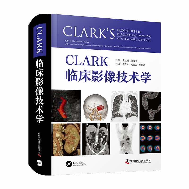 CLARK�R��Ӱ���g(sh��)�W