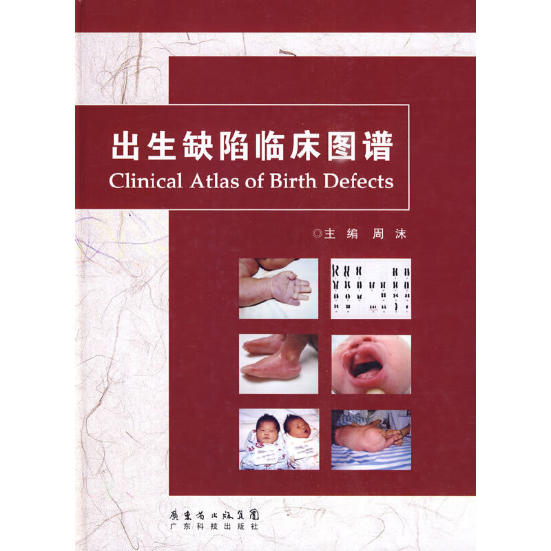 ����ȱ���R���D�V