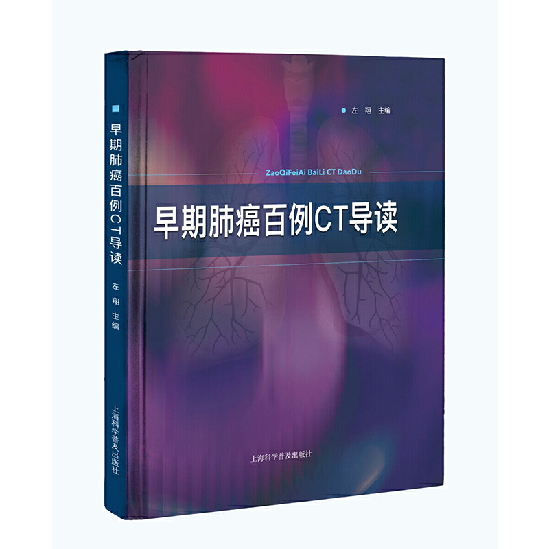 ���ڷΰ�����CT��(d��o)�x