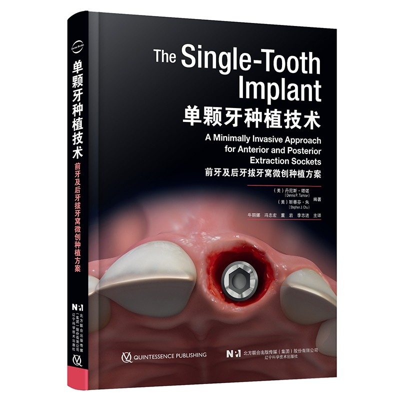 ���w���Nֲ���g(sh��)