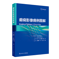 �d�BӰ�����D��