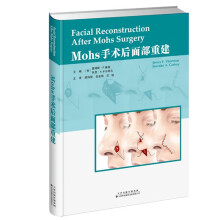 Mohs���g(sh��)���沿�ؽ�