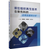 ԭλ�M���������g(sh��)�ڹǂ��Ƶđ�(y��ng)�ü���������