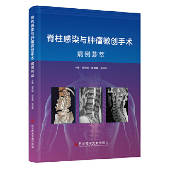  ������Ⱦ�c�[��΢��(chu��ng)���g(sh��)�����C��