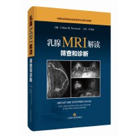  ����MRI���x���Y����\��