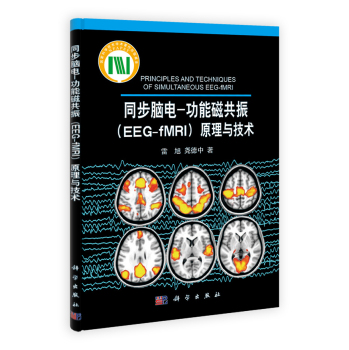 ͬ���X�-���ܴŹ���EEG-fMRI��ԭ���c���g(sh��)
