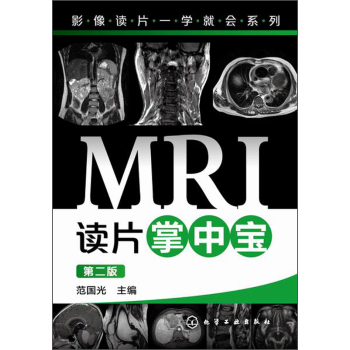 MRI�xƬ���Ќ�