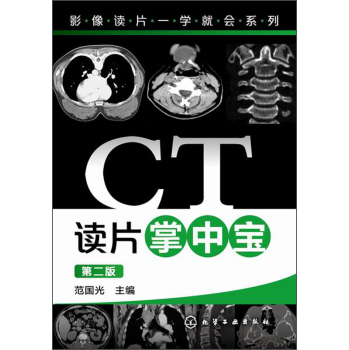 CT�xƬ���Ќ�