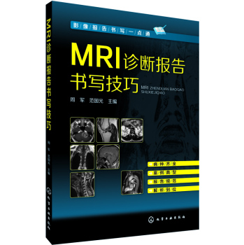 MRI�\������������