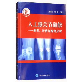 �˹�ϥ�P��(ji��)���ޣ�ԭ���u���c��������