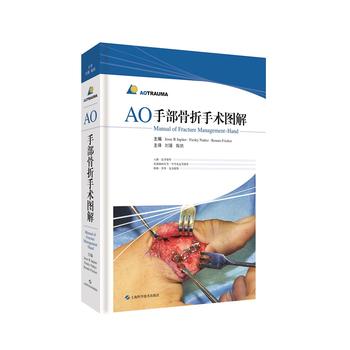 AO�ֲ��������g(sh��)�D��