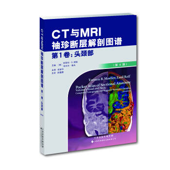 CT�cMRI������ӽ��ʈD�V��1�����^�i������4�棩
