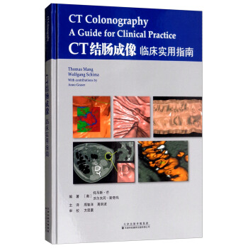 CT�Y(ji��)�c�����R������ָ��