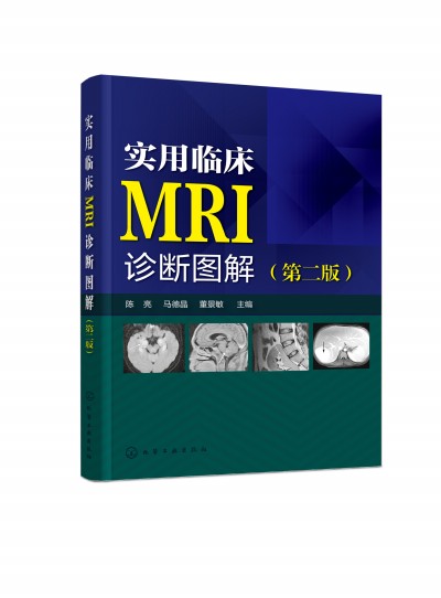 �����R��MRI�\���D�⣨�ڶ��棩