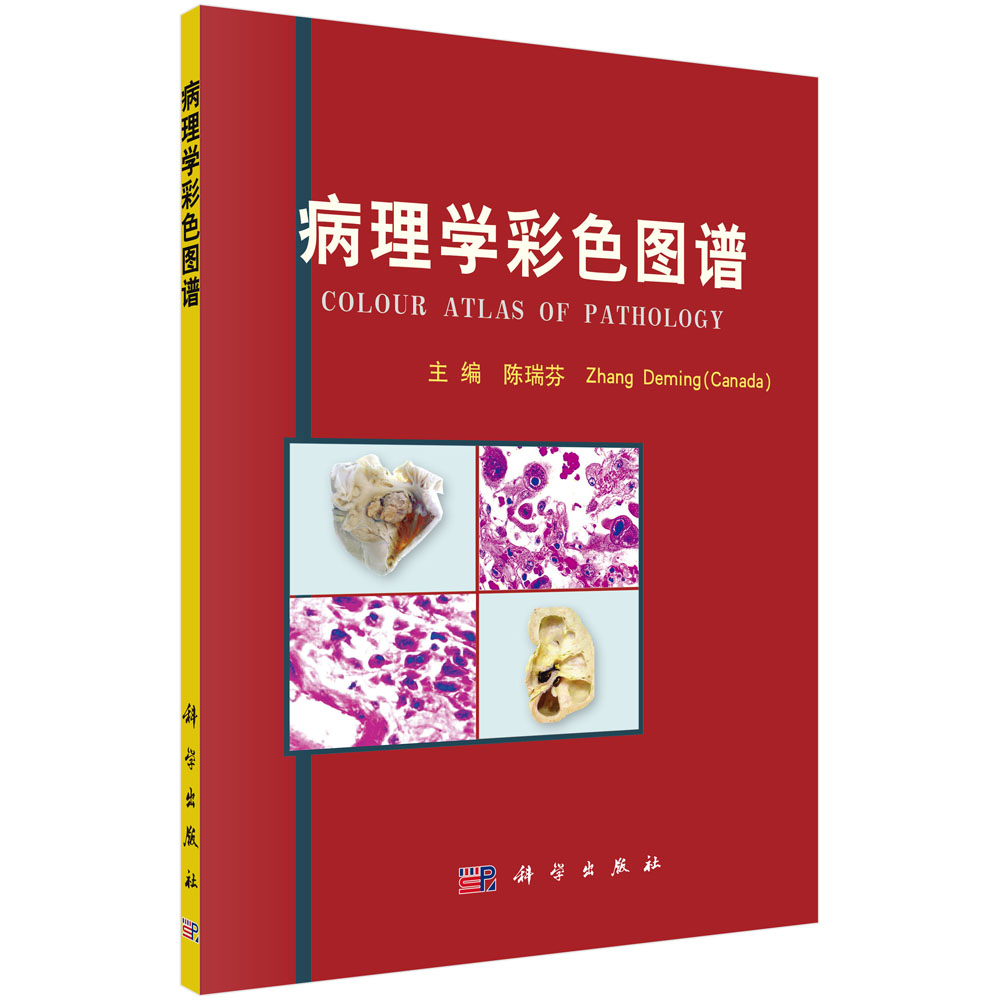 病理學(xué)彩色圖譜