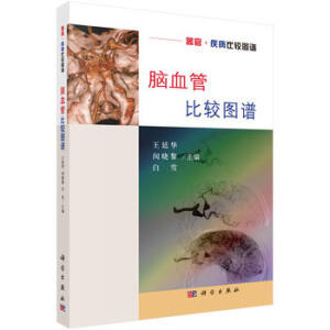 �XѪ�ܱ��^�D�V