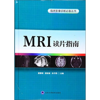 MRI�xƬָ��