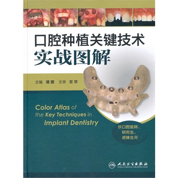 ��ǻ�Nֲ�P(gu��n)�I���g(sh��)��(sh��)��(zh��n)�D��